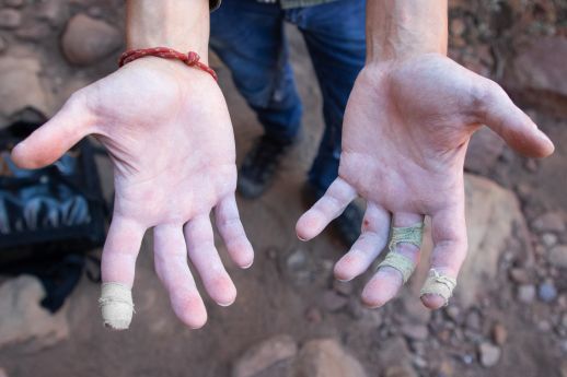 climbers hands turned palms up